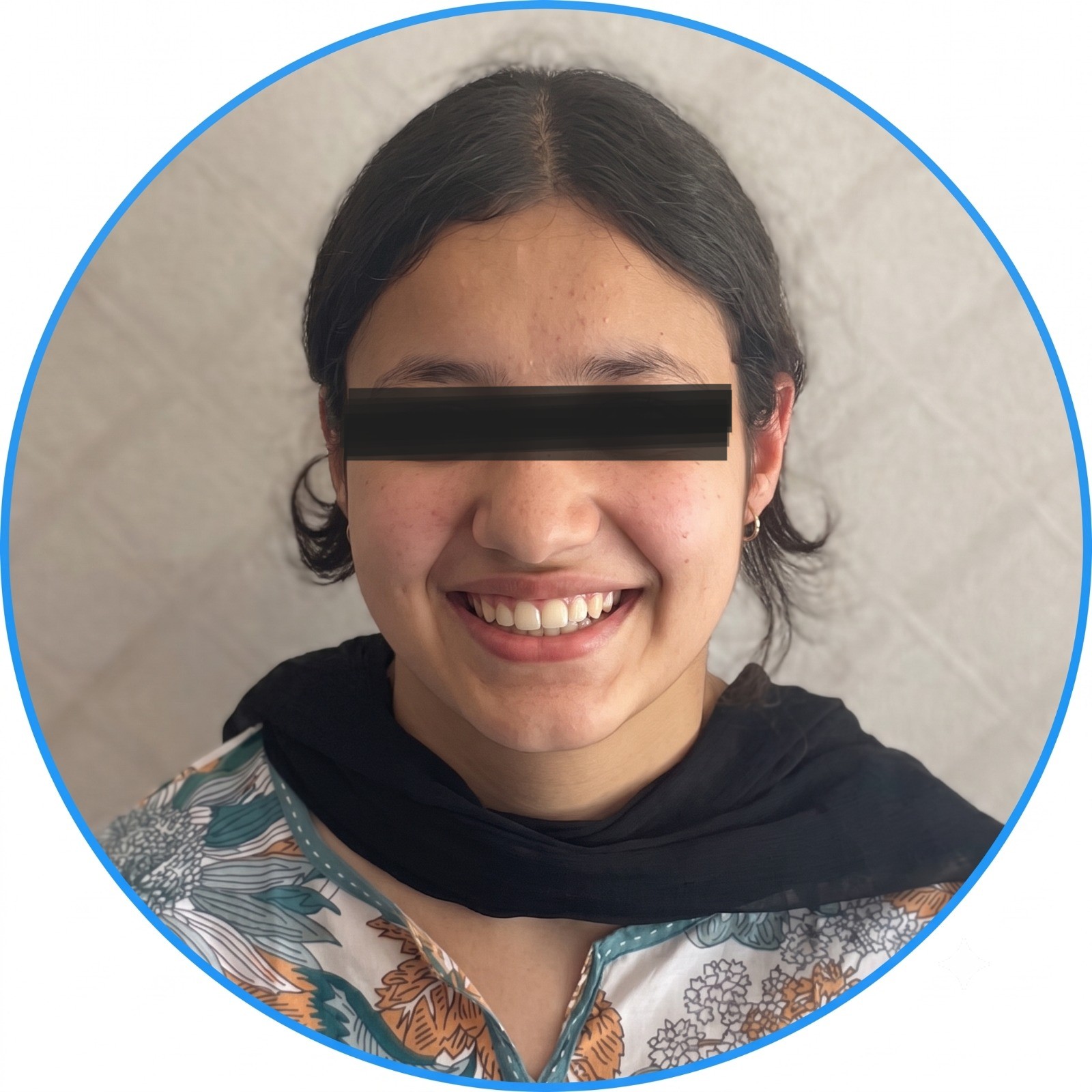 Aligned smile result