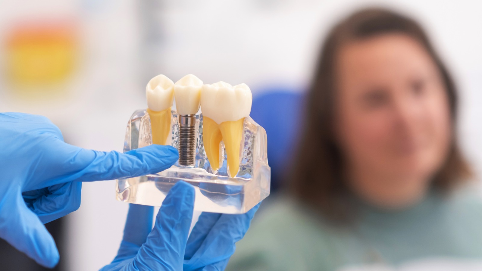 Dental Implants Srinagar