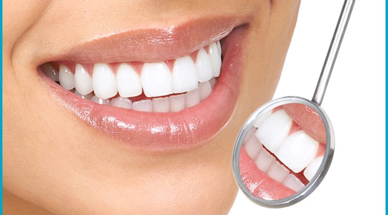 Cosmetic Dentistry Srinagar